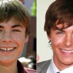 celebrity veneers