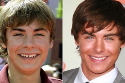 celebrity veneers